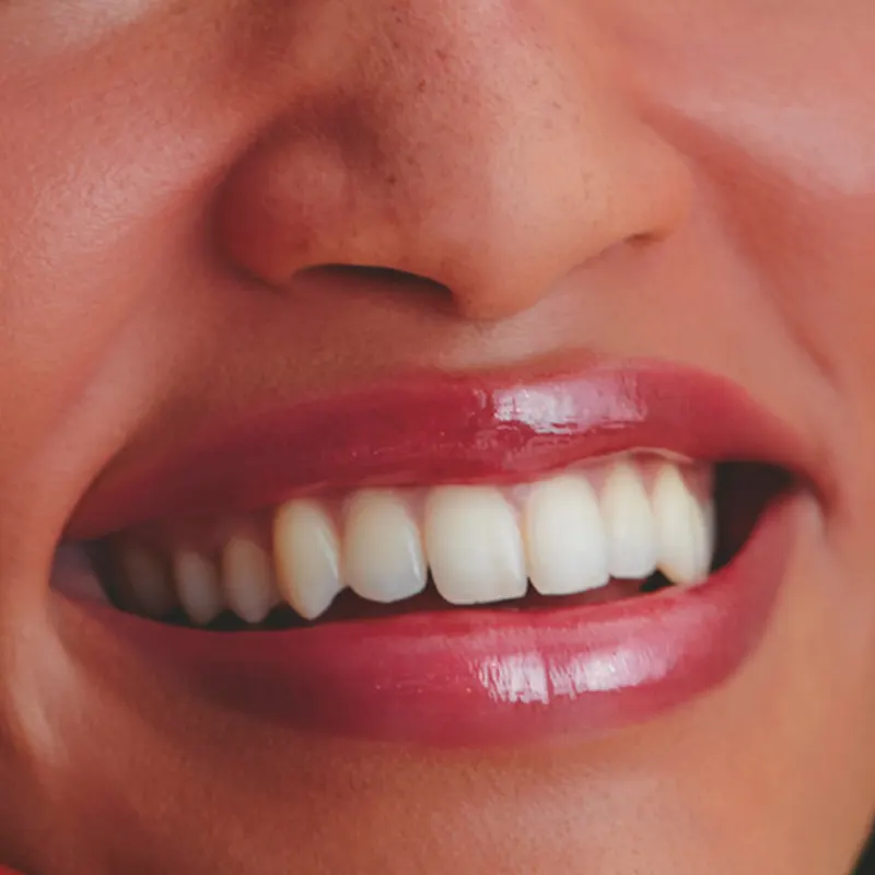 Gloss Brilho Labial Intense Banana 5,2ml